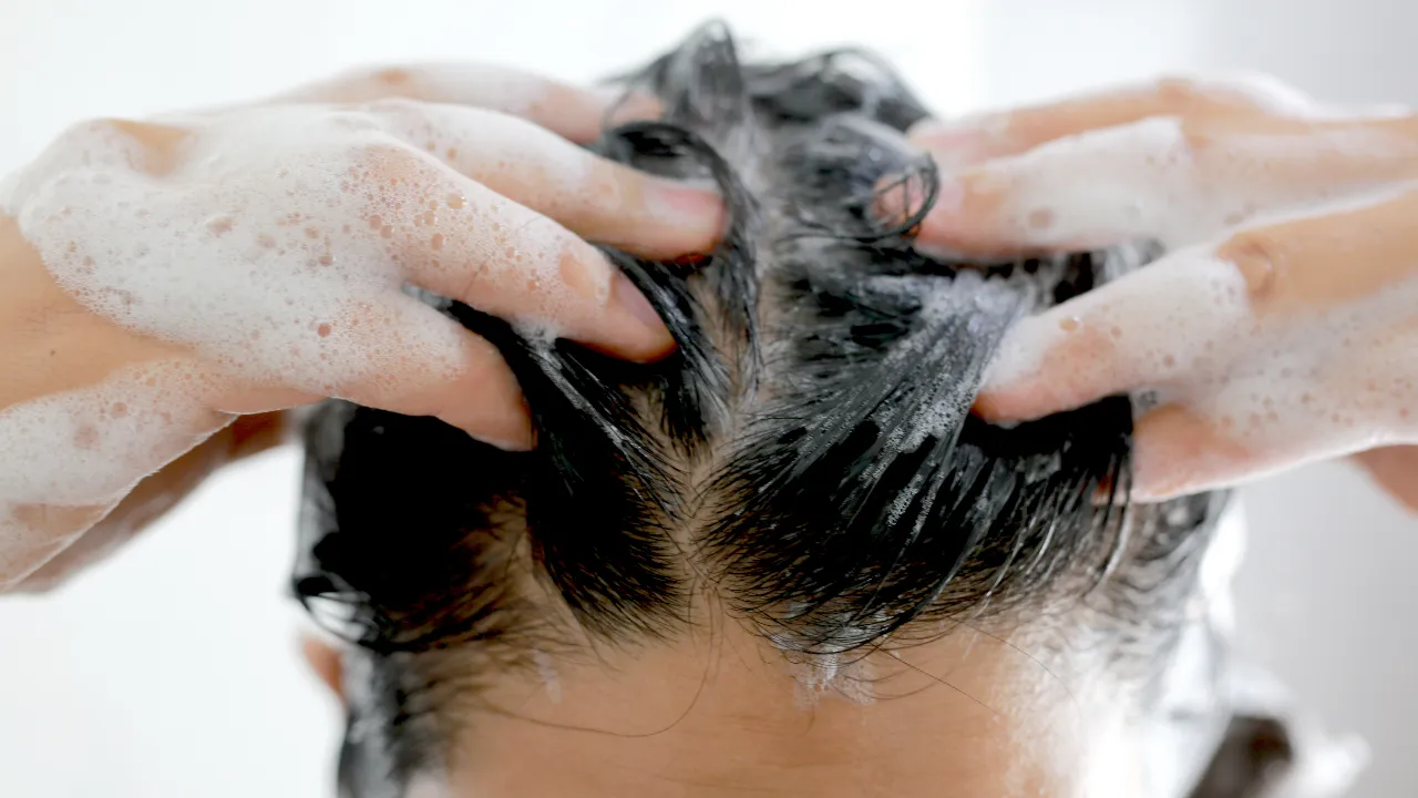 10 แชมพูขจัดรังแค ยี่ห้อไหนดี 2569 ลดคัน ลดเชื้อรา รังแคหาย