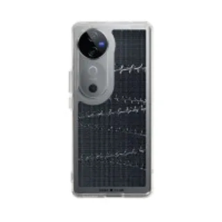 Vivo V40 5G Clear Case Halftone Array (88528799362858852879193435)