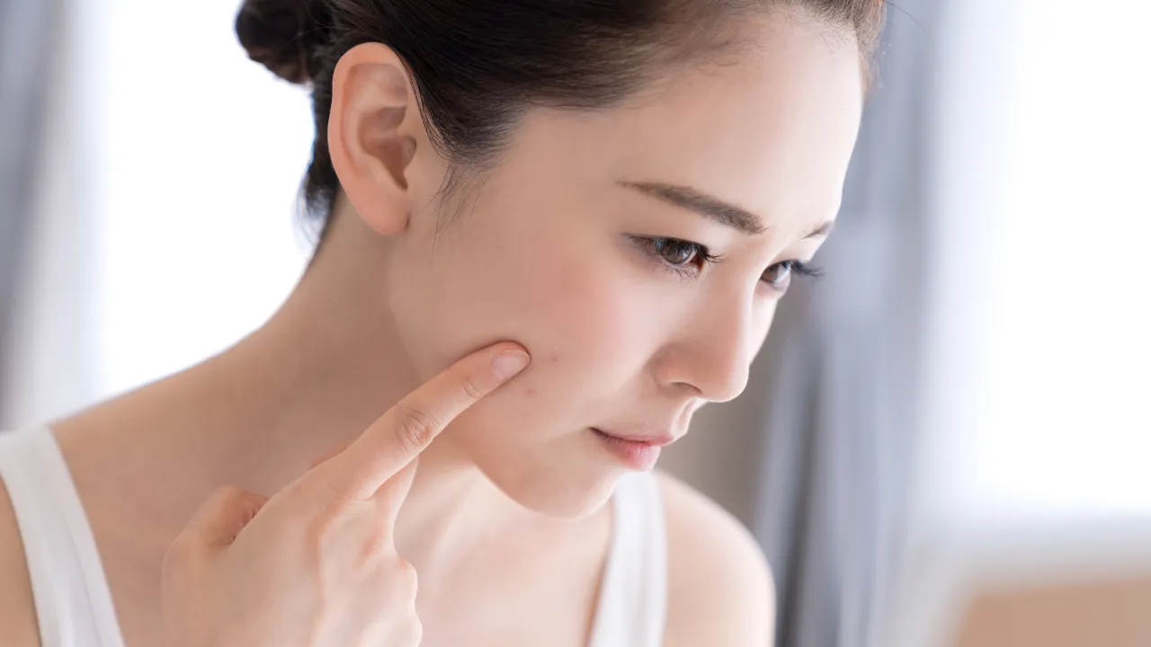 10 เจลแต้มสิว ยี่ห้อไหนดี 2025/2026 ช่วยให้สิวยุบไว ไม่ทิ้งรอย