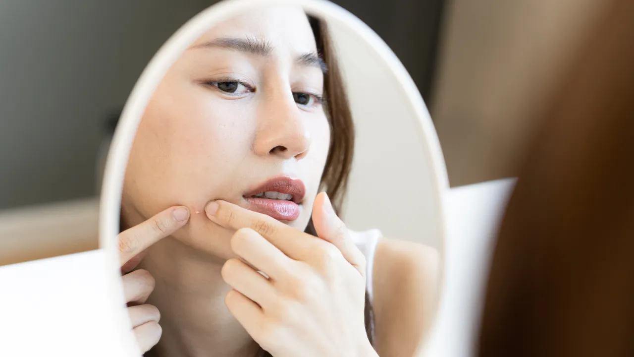 เจลแต้มสิว ยี่ห้อไหนดี 2024 สิวยุบ แห้งไว ไม่ทิ้งรอย